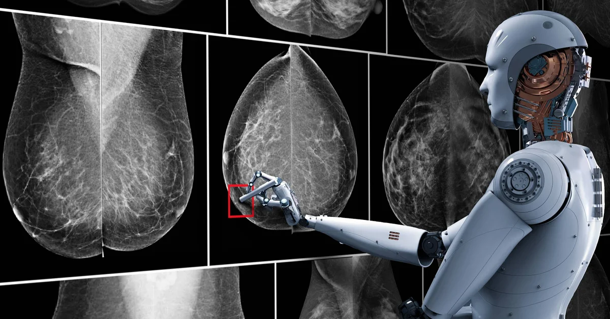 This is how AI that can detect breast cancer faster works