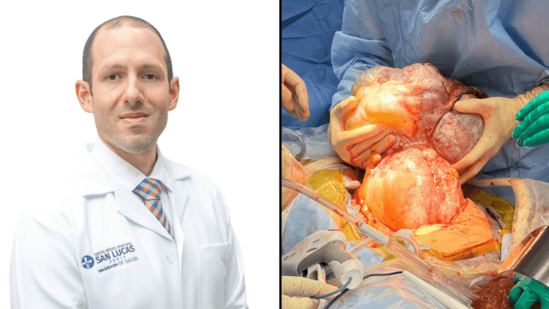 Removal of a large ovarian mass from a Puerto Rican woman
