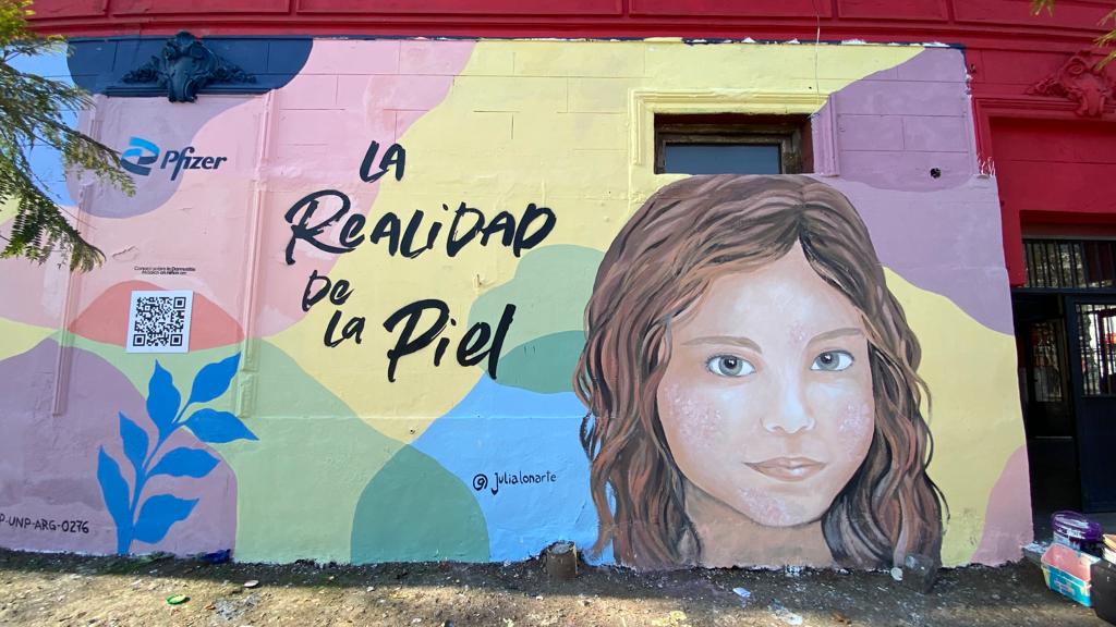 Mural artist Julia Alonso made her contribution to raising awareness about this condition