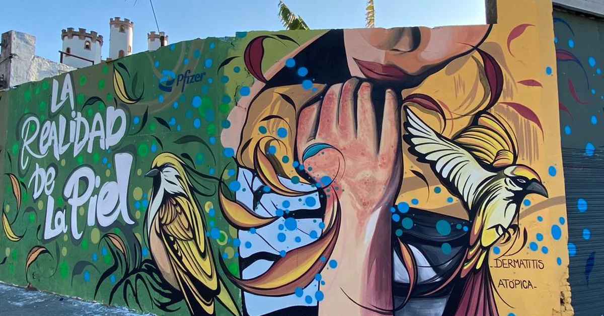 Atopic dermatitis: Three muralists come together to raise awareness about its impact on quality of life